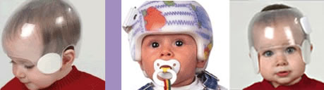 babies_helmet